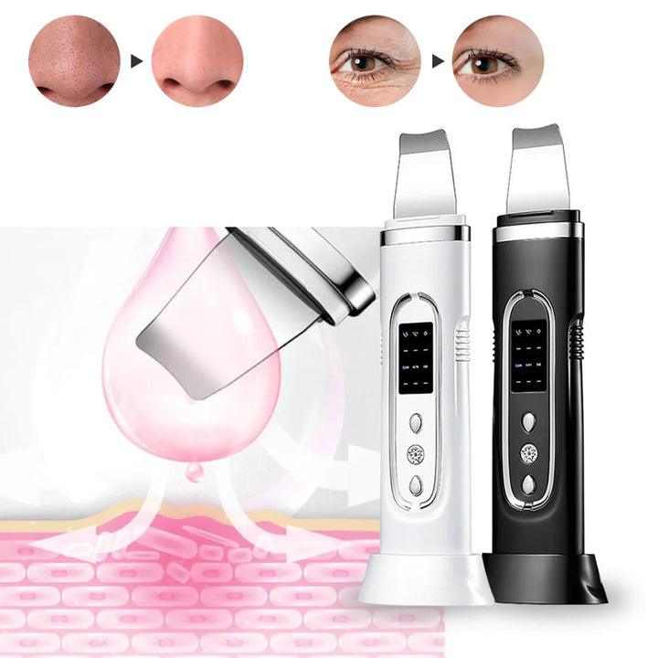 Ultrasonic Skin Scrubber & Blackhead Remover - ABC GOO
