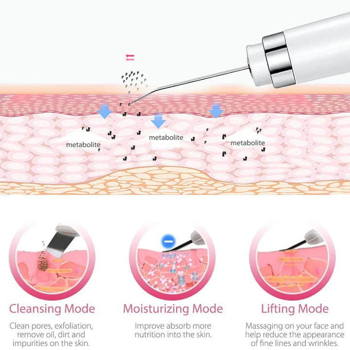Ultrasonic Skin Scrubber & Blackhead Remover - ABC GOO